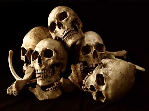 Bones